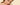 Pigmentation